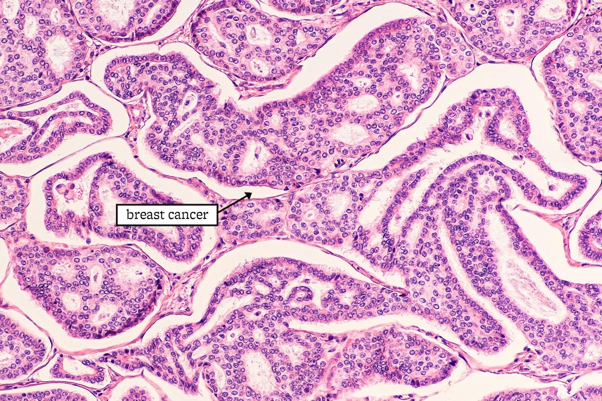 23 Groundbreaking Cancer Research That Could Save Your Life