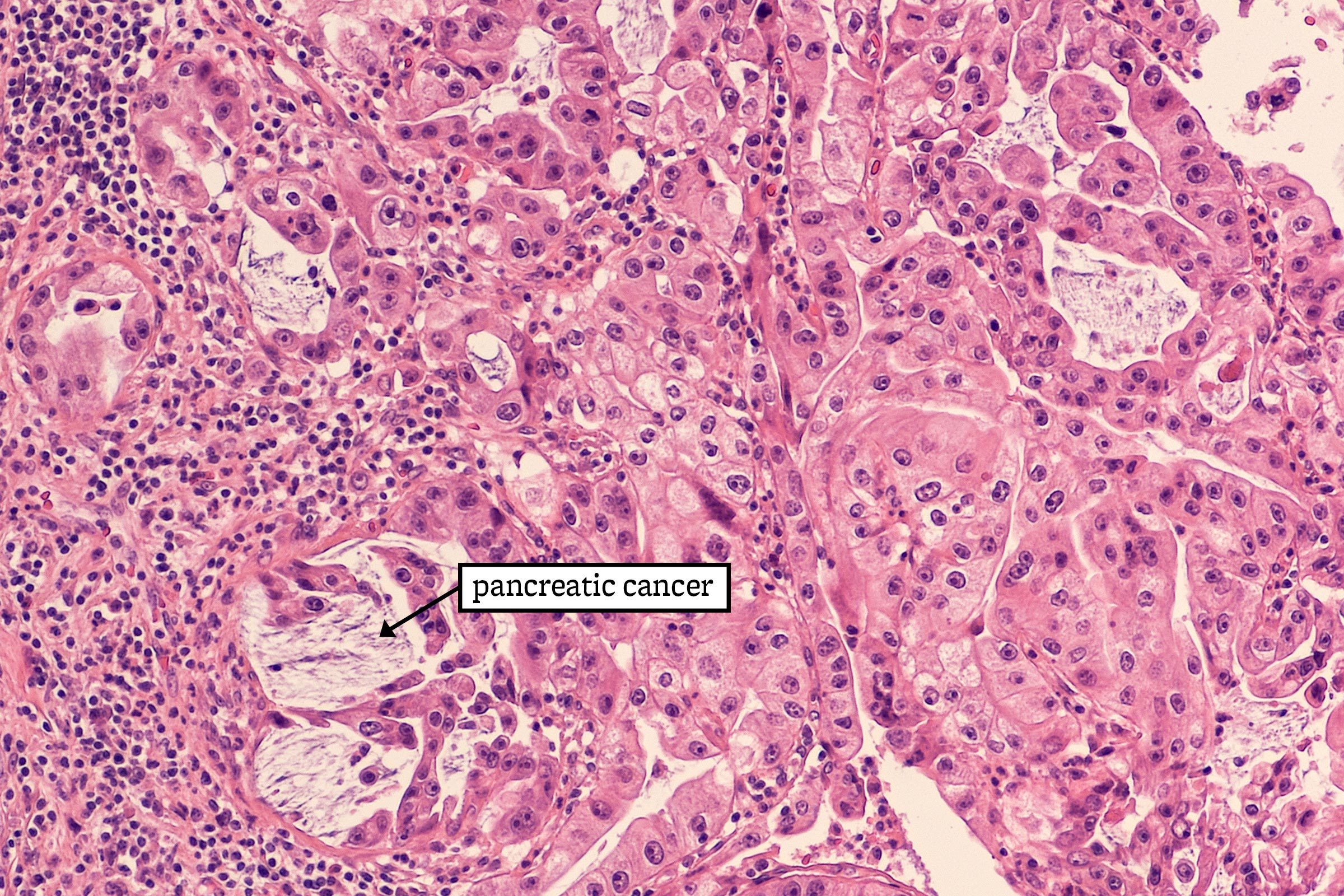 23 Groundbreaking Cancer Research That Could Save Your Life